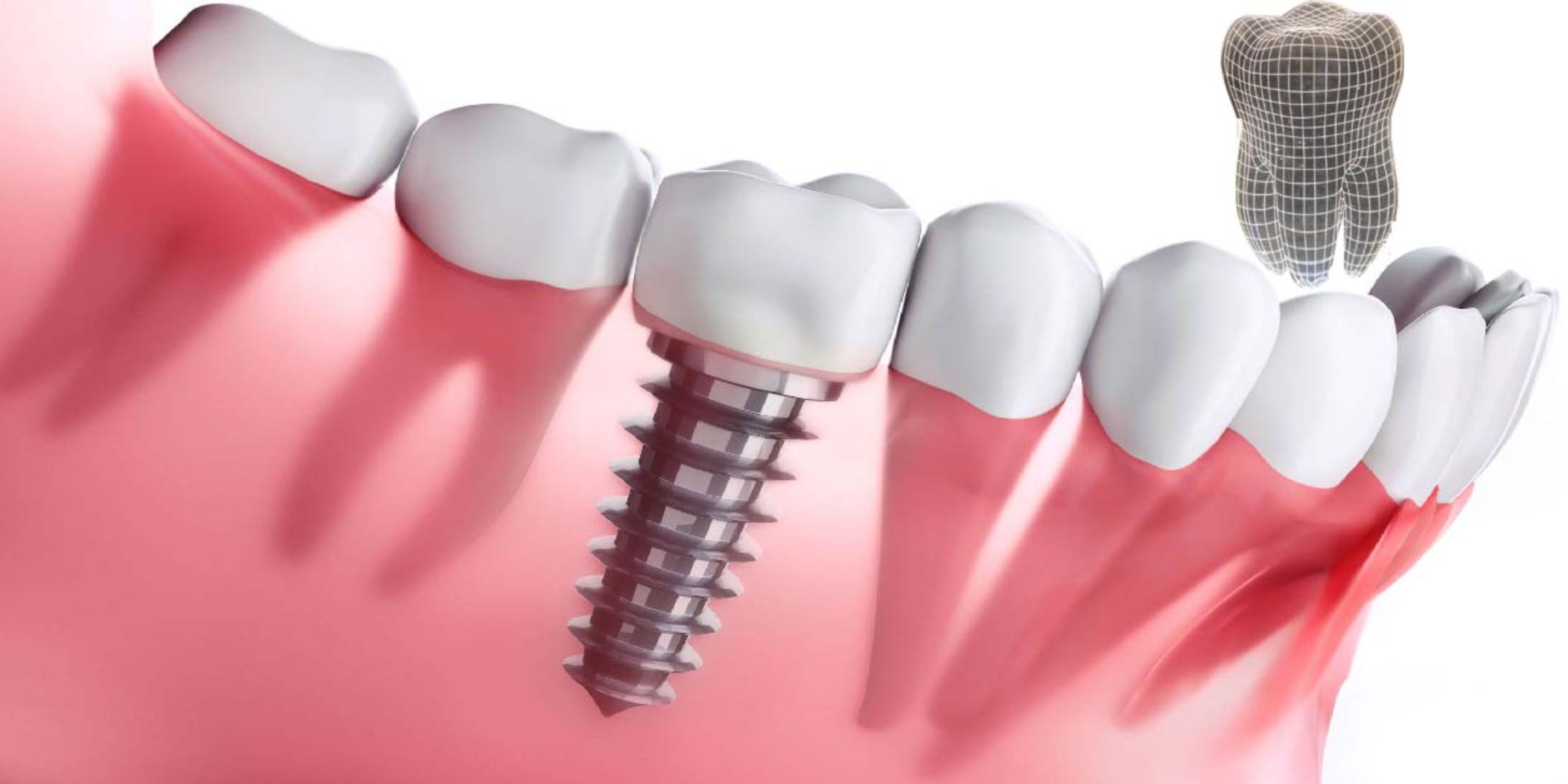 Teeth Heaven Multispeciality Dental Clinic